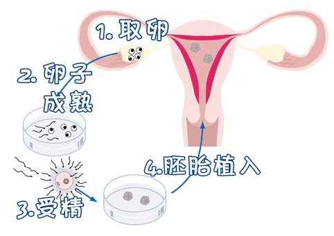 试管婴儿包生男孩公司